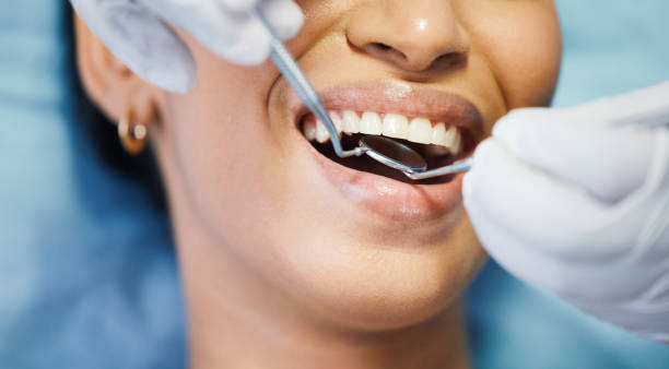 Best Emergency Dentist for Knocked-Out Tooth in Pho, IL